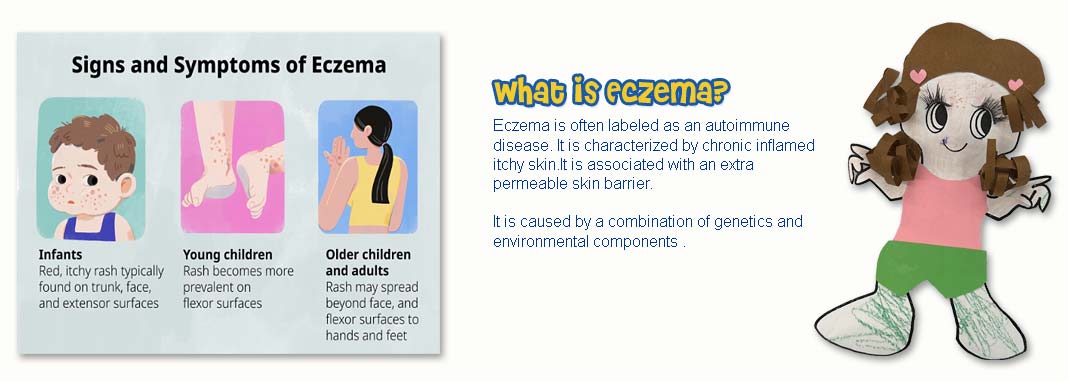 Eczema Time Line Part 2