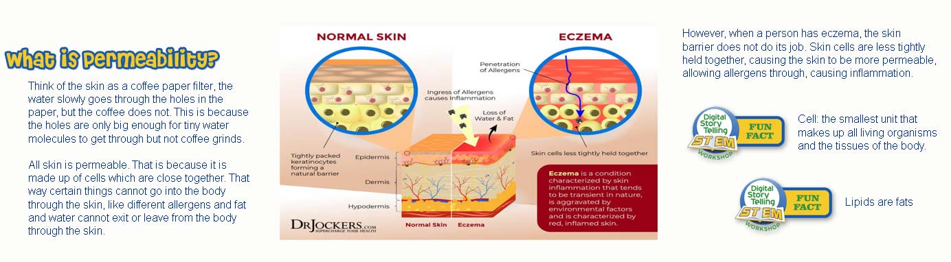Eczema Time Line Part 4